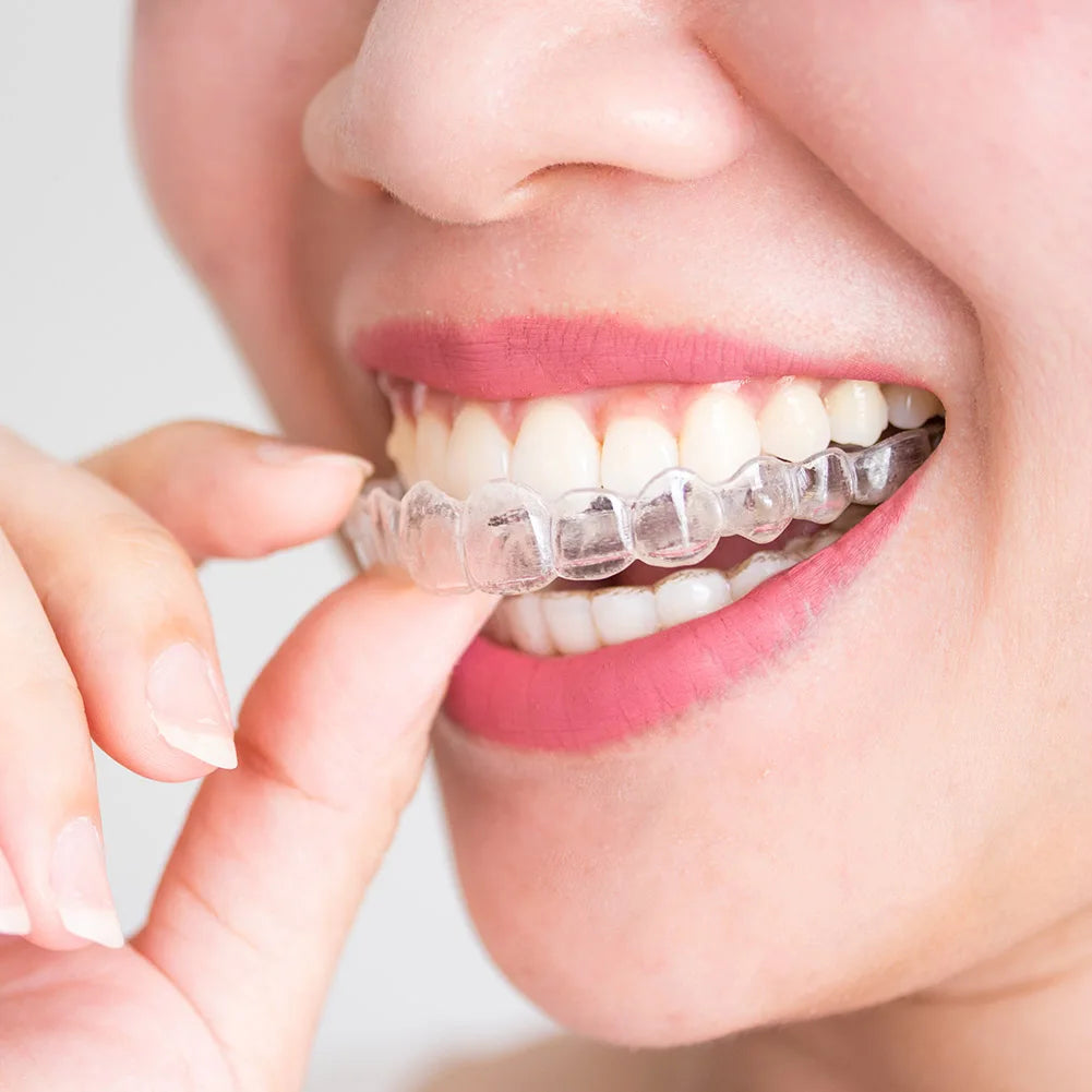 Anti-Snoring & Teeth Grinding Mouth Guard